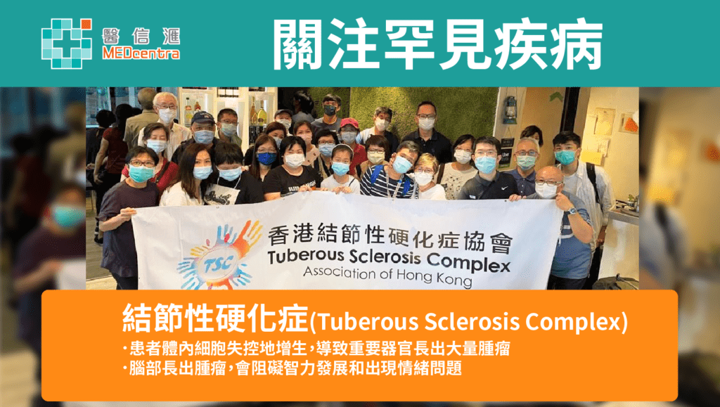 關注罕見基因突變疾病︰結節性硬化症(Tuberous Sclerosis Complex) 1