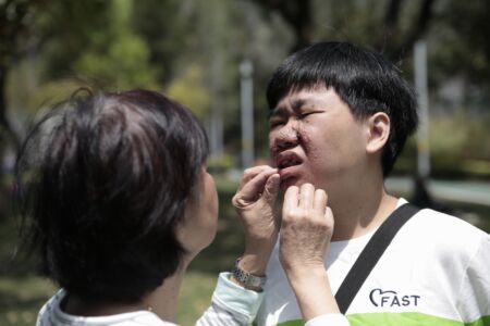 TSC 患者雖然係小眾，但都希望能夠憑著堅毅的精神倡議政策，改善現有的醫療制度變得更加人化 💪💪 58